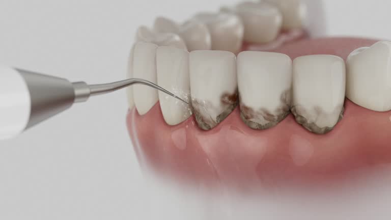 Trusted Teeth Cleaning And Checkup service in Sugar Creek, MO - Dentist Open Now